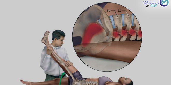 Treatment-of-diseases-with-the-help-of-physiotherapy